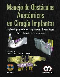 Manejo de Obstculos Anatmicos en Ciruga Implantar