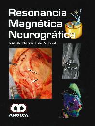 Resonancia Magntica Neurogrfica