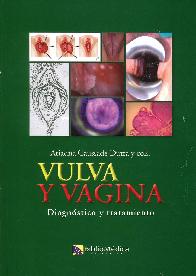 Vulva y Vagina