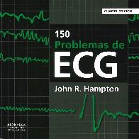 150 Problemas de ECG