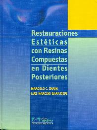 Restauraciones estticas con resinas compuestas en dientes posteriories