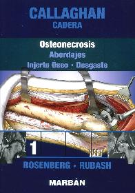 Callaghan Cadera Osteonecrosis 1
