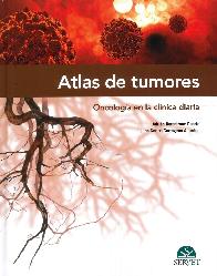 Atlas de Tumores