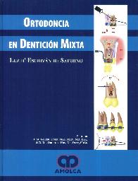 Ortodoncia en denticin mixta
