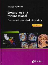 Ecocardiograga tridimensional