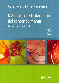 Diagnstico y tratamiento del cncer de mama