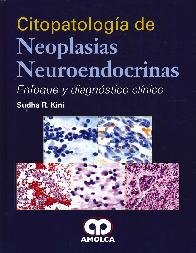 Citopatologa de neoplasias neuroendcrinas