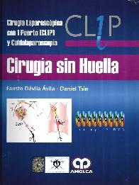 Ciruga sin huella