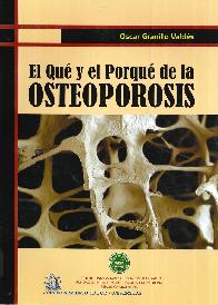 El Qu y el Porqu de la Osteoporosis