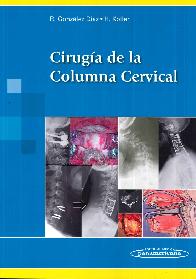 Ciruga de la Columna Cervical