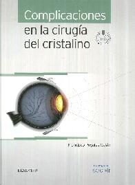 Complicaciones en la Ciruga del Cristalino