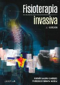 Fisioterapia Invasiva