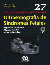 Ultrasonografa de Sndromes Fetales 27