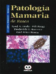 Patologia Mamaria - 2 Tomos