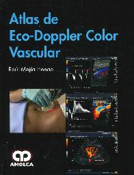 Atlas de Eco-Doppler Color Vascular