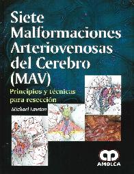 Siete malformaciones arteriovenosas del cerebro (MAV)