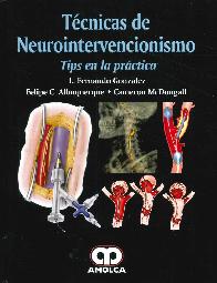 Tcnicas de Neurointervencionismo