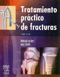 Tratamiento practico de fracturas