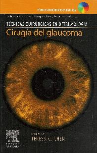 Cirugia del Glaucoma