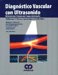 Diagnstico Vascular con Ultrasonido