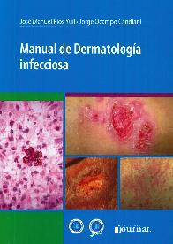 Manual de dermatologa infecciosa