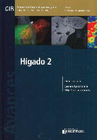 Higado 2