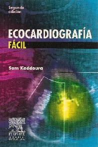 Ecocardiografa fcil