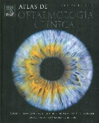 Atlas de Oftalmologia Clinica