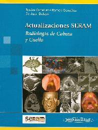 Actualizaciones SERAM Radiolga de cabeza y cuello