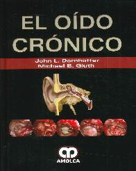 El Odo Crnico