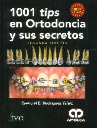 1001 Tips en Ortodoncia y sus Secretos