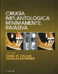 Ciruga Implantolgica Mnimamente Invasiva