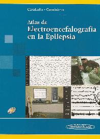 Atlas de Electroencefalografa en la Epilepsia