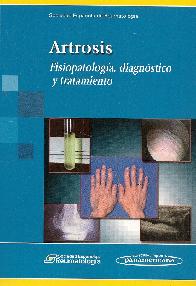 Artrosis