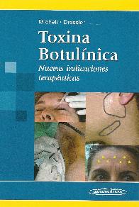 Toxina Botulnica