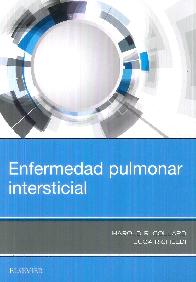 Enfermedad Pulmonar Intersticial