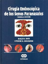 Ciruga Endoscpica de los Senos Paranasales