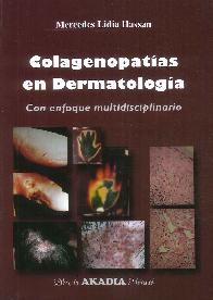 Colagenopatas en Dermatologa