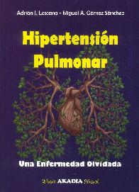 Hipertensin Pulmonar