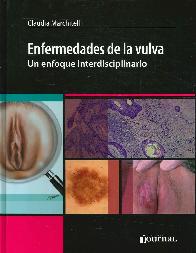 Enfermedades de la vulva. Un enfoque interdisciplinario