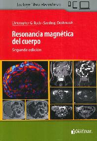 Resonancia magnetica del cuerpo