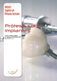 Prtesis sobre implantes