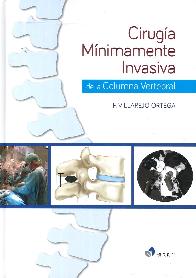 Ciruga Mnimamente Invasiva de la Columna Vertebral