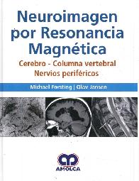 Neuroimagen por resonancia magntica