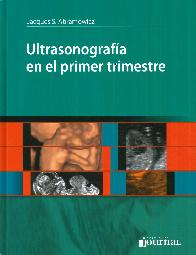 Ultrasonografa en el primer trimestre