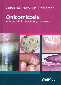 Onicomicosis