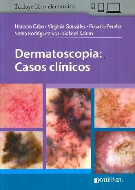 Dermatoscopia : casos clínicos