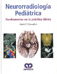 Neurorradiologa Peditrica