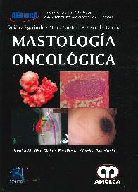 Mastologa Oncolgica