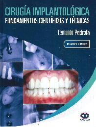 Ciruga Implantolgica